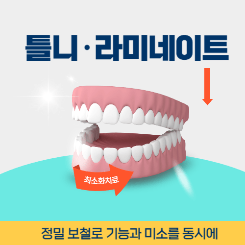 시흥치과 시흥시 치과 틀니 라미네이트